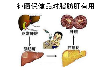 补硒保健品对脂肪肝有用