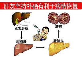 肝友坚持补硒有利于病情恢复