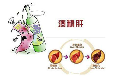 肝病越严重 血硒含量越低