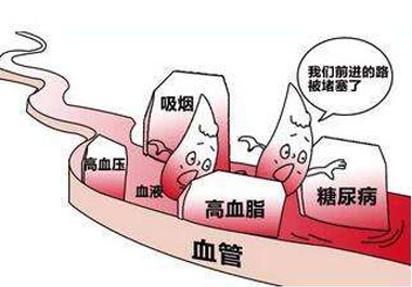 为何心血管疾病成为糖尿病的“终极杀手”