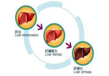 乙肝传染的五个途径及预防方法