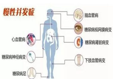 糖尿病并发症