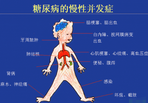 你还在害怕糖尿病吗？科学补硒不“恐糖”