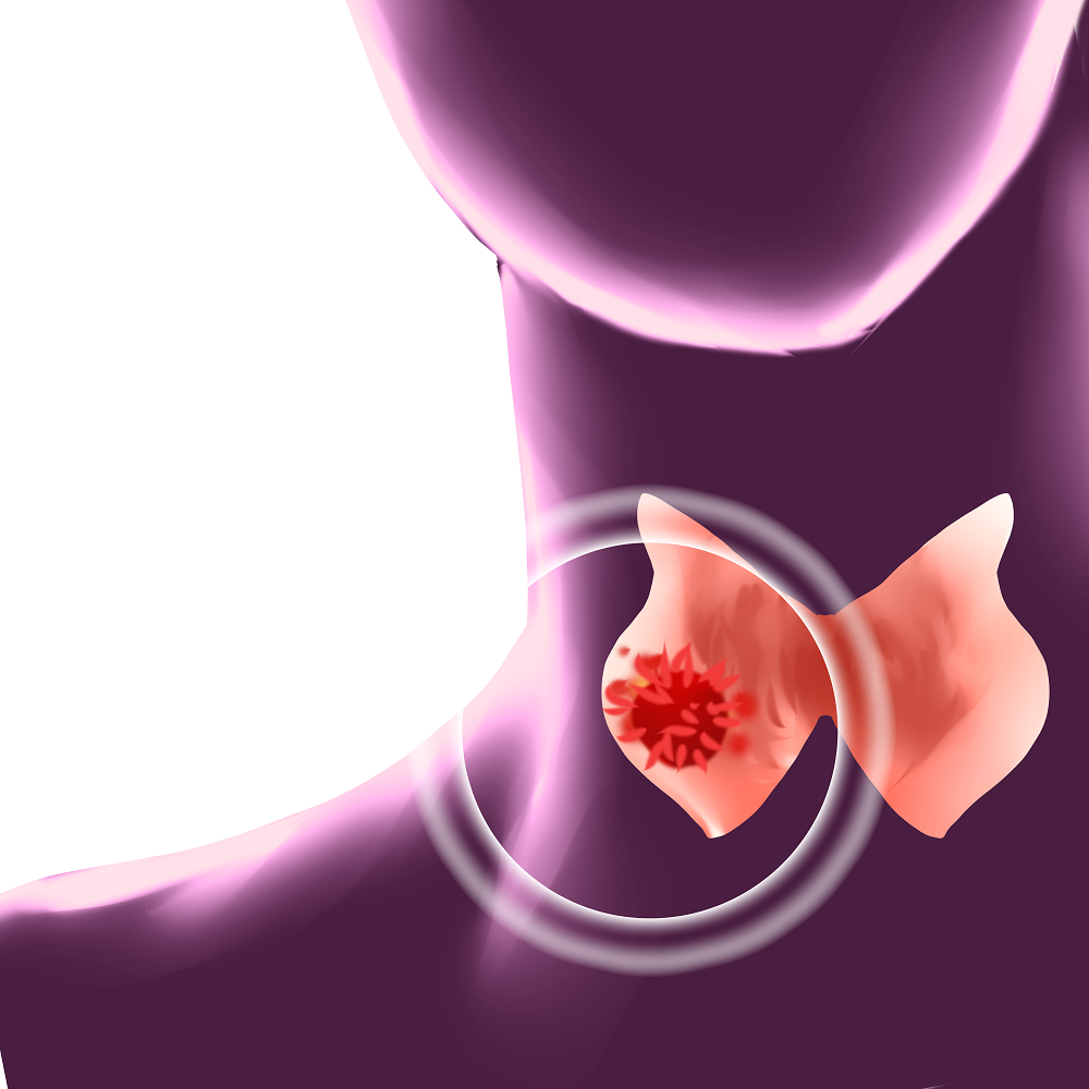 甲状腺不能光注重补碘，还要补点硒