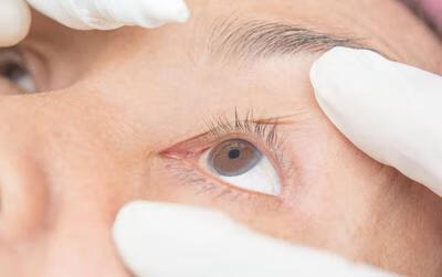 补硒可预防多种眼部疾病